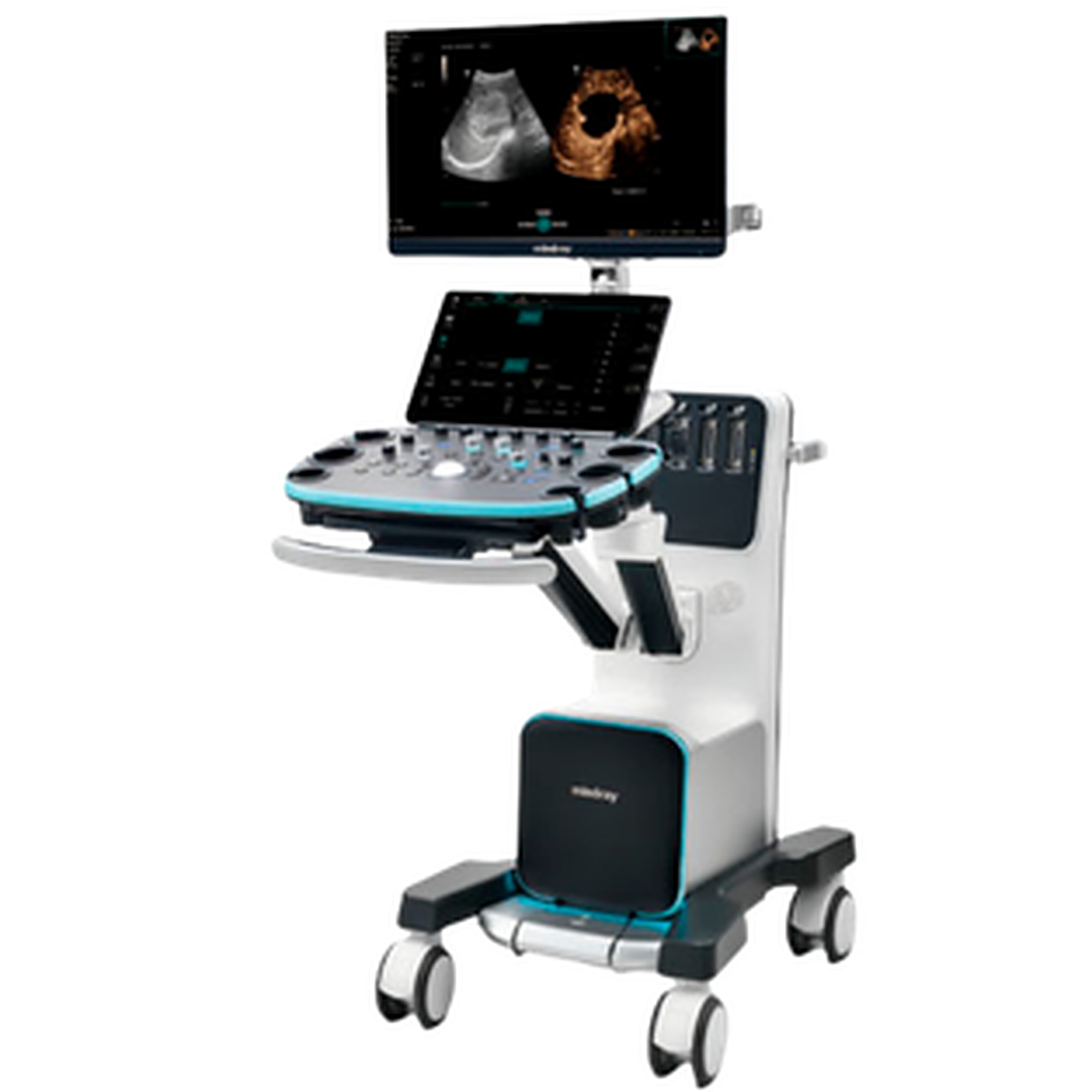 Ultrassom Resona I9