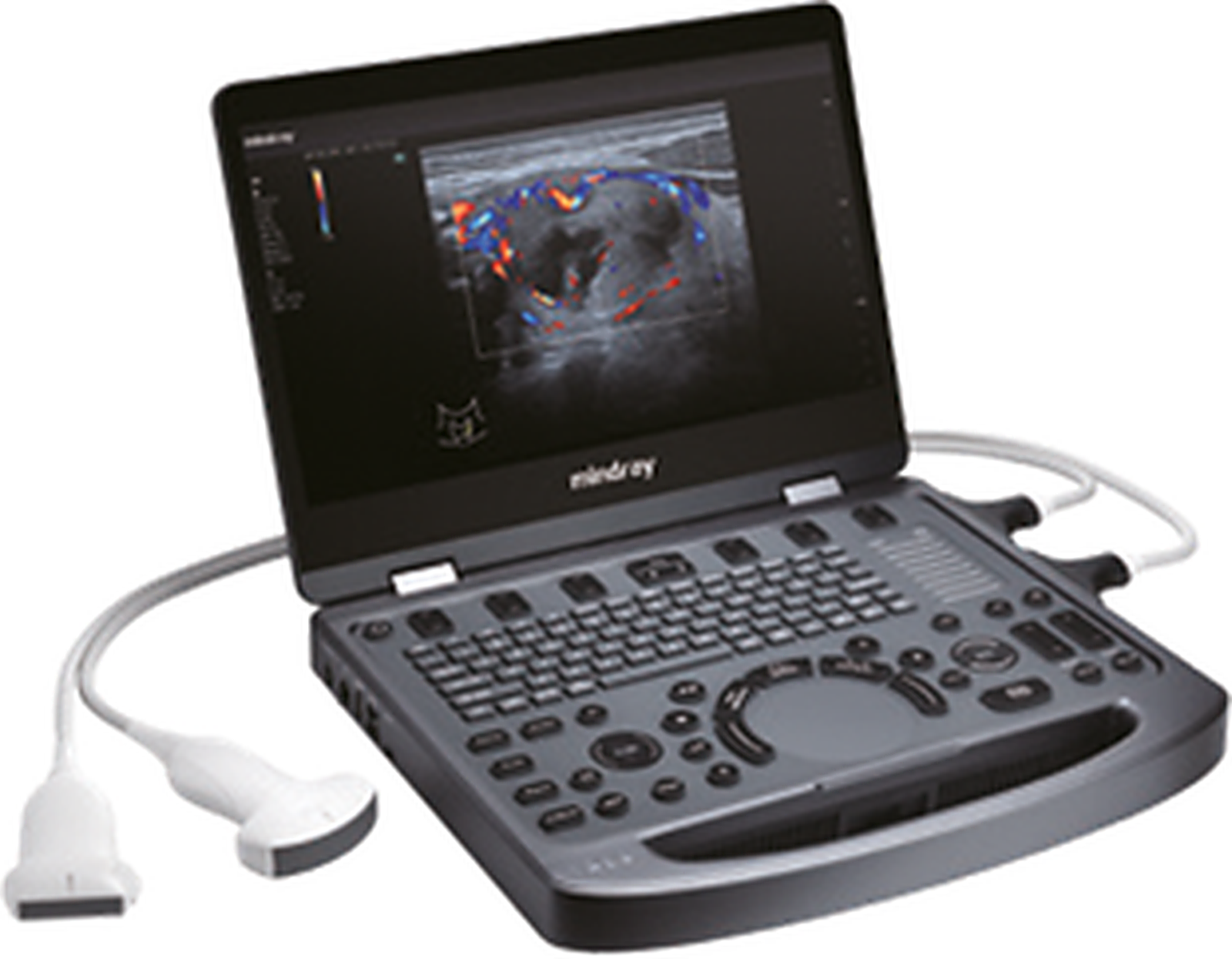 Ultrassom MX3