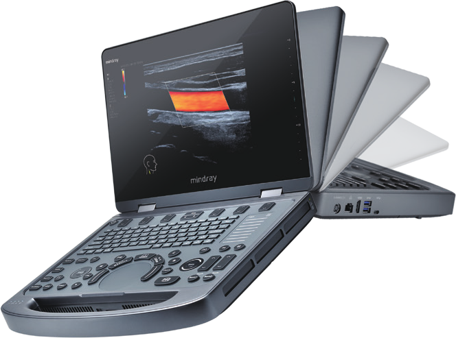 Ultrassom MX6