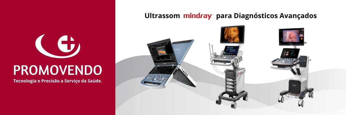 Como Escolher o Melhor Equipamento de Ultrassonografia para sua Clínica?