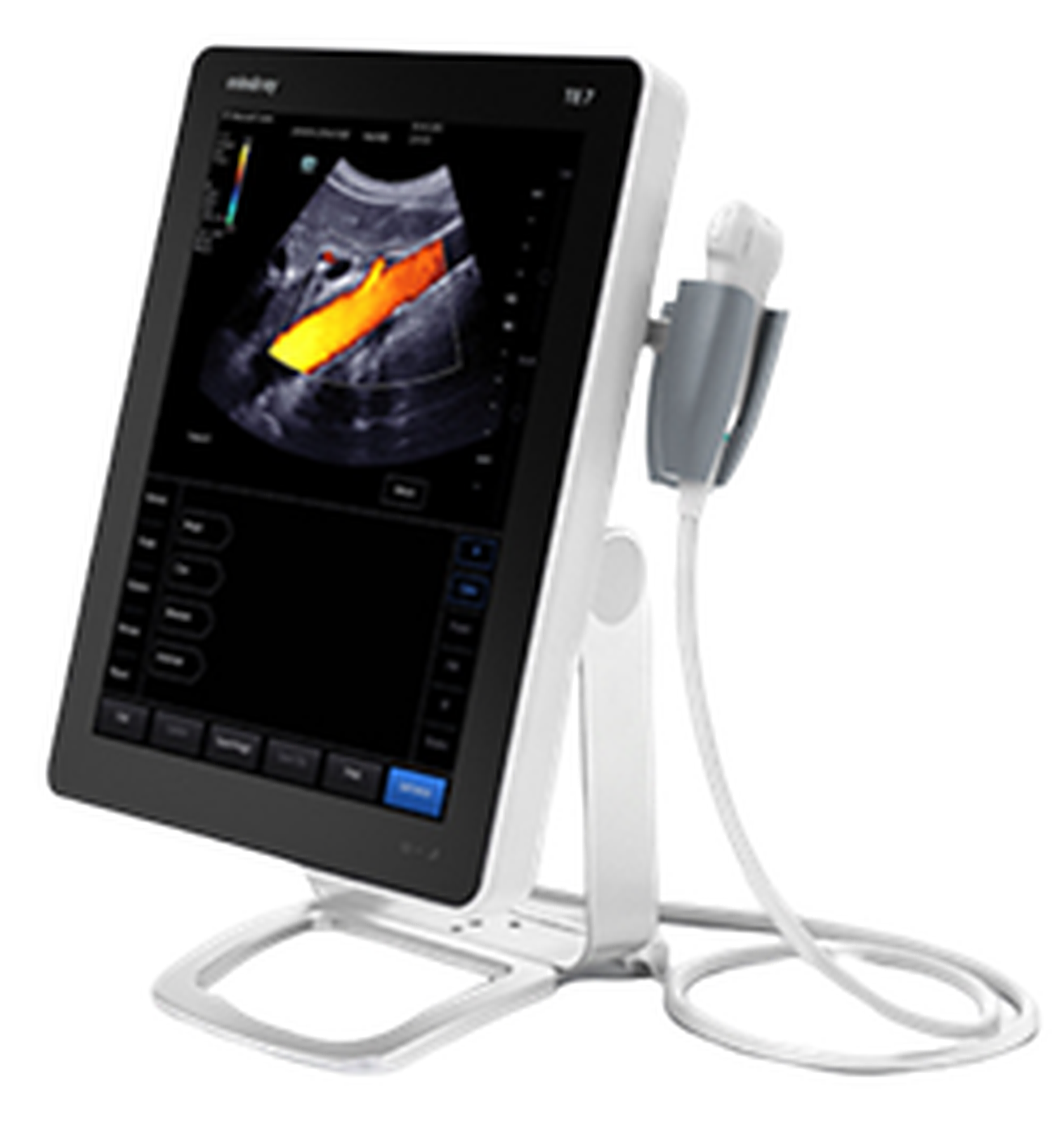 Ultrassom TE7
