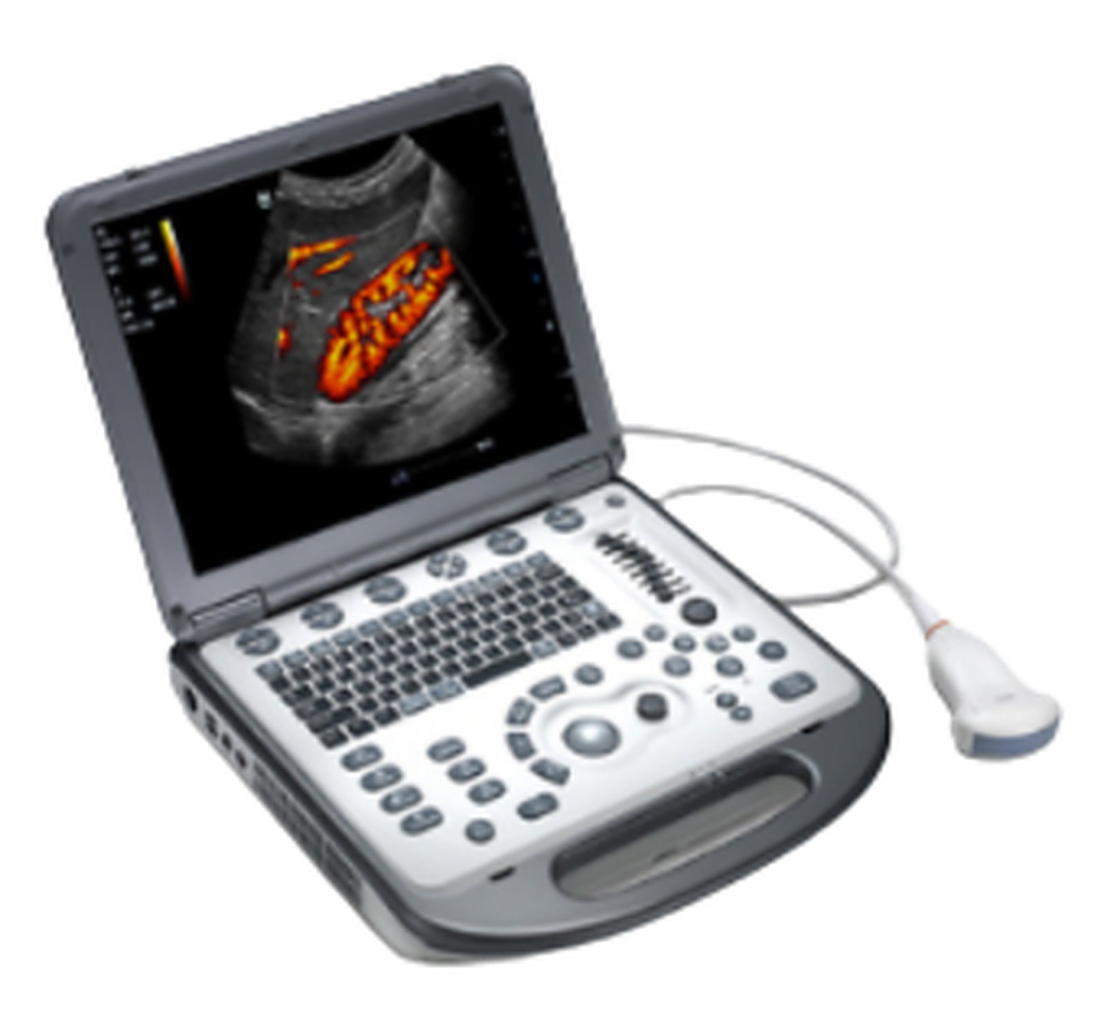 Ultrassom M6