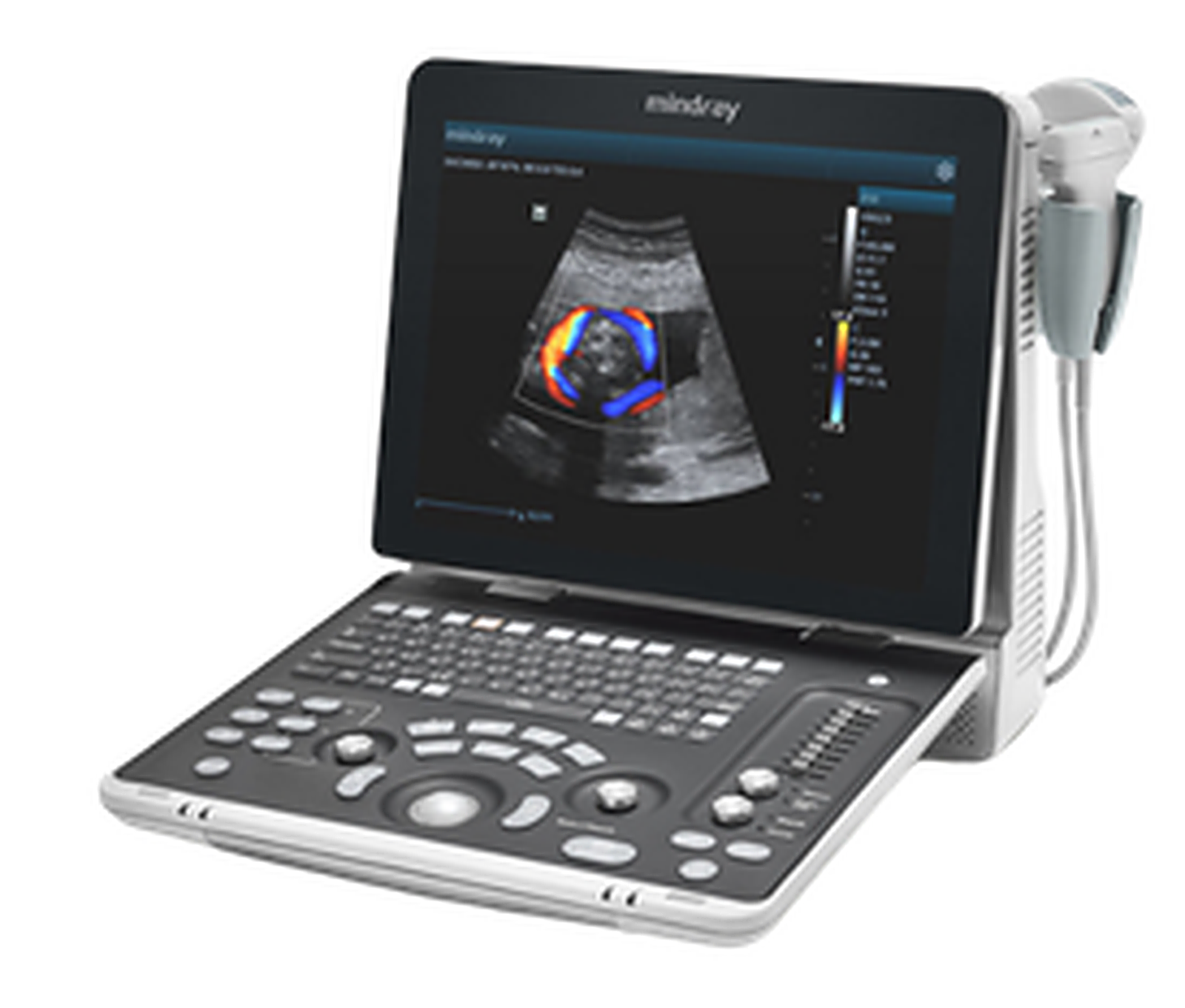 Ultrassom Z50